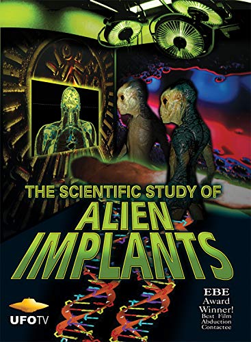 【中古】【未使用・未開封品】Scientific Study of Alien Implants [DVD] [Import]