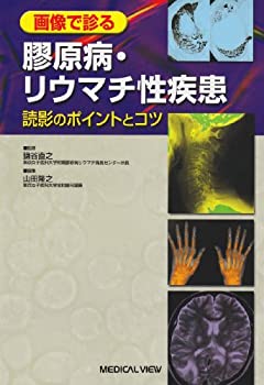 【状態】中古品（非常に良い）【メーカー名】メジカルビュー社【メーカー型番】【ブランド名】掲載画像は全てイメージです。実際の商品とは色味等異なる場合がございますのでご了承ください。【 ご注文からお届けまで 】・ご注文　：ご注文は24時間受け付けております。・注文確認：当店より注文確認メールを送信いたします。・入金確認：ご決済の承認が完了した翌日よりお届けまで2〜7営業日前後となります。　※海外在庫品の場合は2〜4週間程度かかる場合がございます。　※納期に変更が生じた際は別途メールにてご確認メールをお送りさせて頂きます。　※お急ぎの場合は事前にお問い合わせください。・商品発送：出荷後に配送業者と追跡番号等をメールにてご案内致します。　※離島、北海道、九州、沖縄は遅れる場合がございます。予めご了承下さい。　※ご注文後、当店よりご注文内容についてご確認のメールをする場合がございます。期日までにご返信が無い場合キャンセルとさせて頂く場合がございますので予めご了承下さい。【 在庫切れについて 】他モールとの併売品の為、在庫反映が遅れてしまう場合がございます。完売の際はメールにてご連絡させて頂きますのでご了承ください。【 初期不良のご対応について 】・商品が到着致しましたらなるべくお早めに商品のご確認をお願いいたします。・当店では初期不良があった場合に限り、商品到着から7日間はご返品及びご交換を承ります。初期不良の場合はご購入履歴の「ショップへ問い合わせ」より不具合の内容をご連絡ください。・代替品がある場合はご交換にて対応させていただきますが、代替品のご用意ができない場合はご返品及びご注文キャンセル（ご返金）とさせて頂きますので予めご了承ください。【 中古品ついて 】中古品のため画像の通りではございません。また、中古という特性上、使用や動作に影響の無い程度の使用感、経年劣化、キズや汚れ等がある場合がございますのでご了承の上お買い求めくださいませ。◆ 付属品について商品タイトルに記載がない場合がありますので、ご不明な場合はメッセージにてお問い合わせください。商品名に『付属』『特典』『○○付き』等の記載があっても特典など付属品が無い場合もございます。ダウンロードコードは付属していても使用及び保証はできません。中古品につきましては基本的に動作に必要な付属品はございますが、説明書・外箱・ドライバーインストール用のCD-ROM等は付属しておりません。◆ ゲームソフトのご注意点・商品名に「輸入版 / 海外版 / IMPORT」と記載されている海外版ゲームソフトの一部は日本版のゲーム機では動作しません。お持ちのゲーム機のバージョンなど対応可否をお調べの上、動作の有無をご確認ください。尚、輸入版ゲームについてはメーカーサポートの対象外となります。◆ DVD・Blu-rayのご注意点・商品名に「輸入版 / 海外版 / IMPORT」と記載されている海外版DVD・Blu-rayにつきましては映像方式の違いの為、一般的な国内向けプレイヤーにて再生できません。ご覧になる際はディスクの「リージョンコード」と「映像方式(DVDのみ)」に再生機器側が対応している必要があります。パソコンでは映像方式は関係ないため、リージョンコードさえ合致していれば映像方式を気にすることなく視聴可能です。・商品名に「レンタル落ち 」と記載されている商品につきましてはディスクやジャケットに管理シール（値札・セキュリティータグ・バーコード等含みます）が貼付されています。ディスクの再生に支障の無い程度の傷やジャケットに傷み（色褪せ・破れ・汚れ・濡れ痕等）が見られる場合があります。予めご了承ください。◆ トレーディングカードのご注意点トレーディングカードはプレイ用です。中古買取り品の為、細かなキズ・白欠け・多少の使用感がございますのでご了承下さいませ。再録などで型番が違う場合がございます。違った場合でも事前連絡等は致しておりませんので、型番を気にされる方はご遠慮ください。