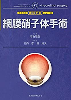 【中古】 網膜硝子体手術 (イラスト眼科手術シリーズ 6)