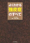 【中古】 よくわかる強皮症のすべて