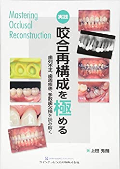 楽天AJIMURA-SHOP【中古】 実践 咬合再構成を極める 歯列不正、歯周疾患、多数歯欠損を読み解く