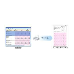 OMRON オムロン 心電図印刷ソフト HCG-SOFT-2