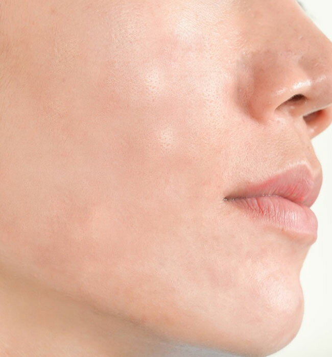 マスクによる肌荒れを防ぐ「フェイスクリーム」2個セット！マスク着用による不快な肌トラブルを快適にサポート！ 2