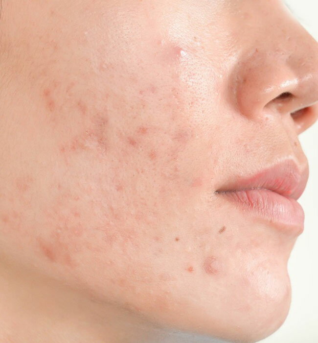 マスクによる肌荒れを防ぐ「フェイスクリーム」2個セット！マスク着用による不快な肌トラブルを快適にサポート！ 3