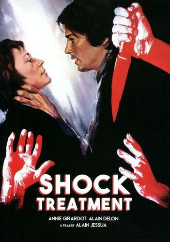 【輸入盤DVD】【新品】Shock Treatment