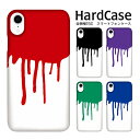 AQUOS U ケース SHV37 ケース スマホケース アクオス U ハードケース 垂れペンキ/W au SHARP シャープ DM便送料無料 スマートフォン クリア加工 スマホ ケース ハードカバー 多機種対応 クリアケース スマホ ポリウレタン スマホ カバー PU 人気 PU ハードケース オリジナル(2)