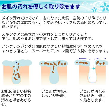 【お得なセット】ビセキノンオイルクレンジング200g　フレウォッシュ50g　ローション30ml　ほぐれしあ5g　のお得なセット　べたつきヌルヌル感なし！すっきり落ちるけどしっとり。9250円が7400円に！　amity biseki アミティ　ビセキ