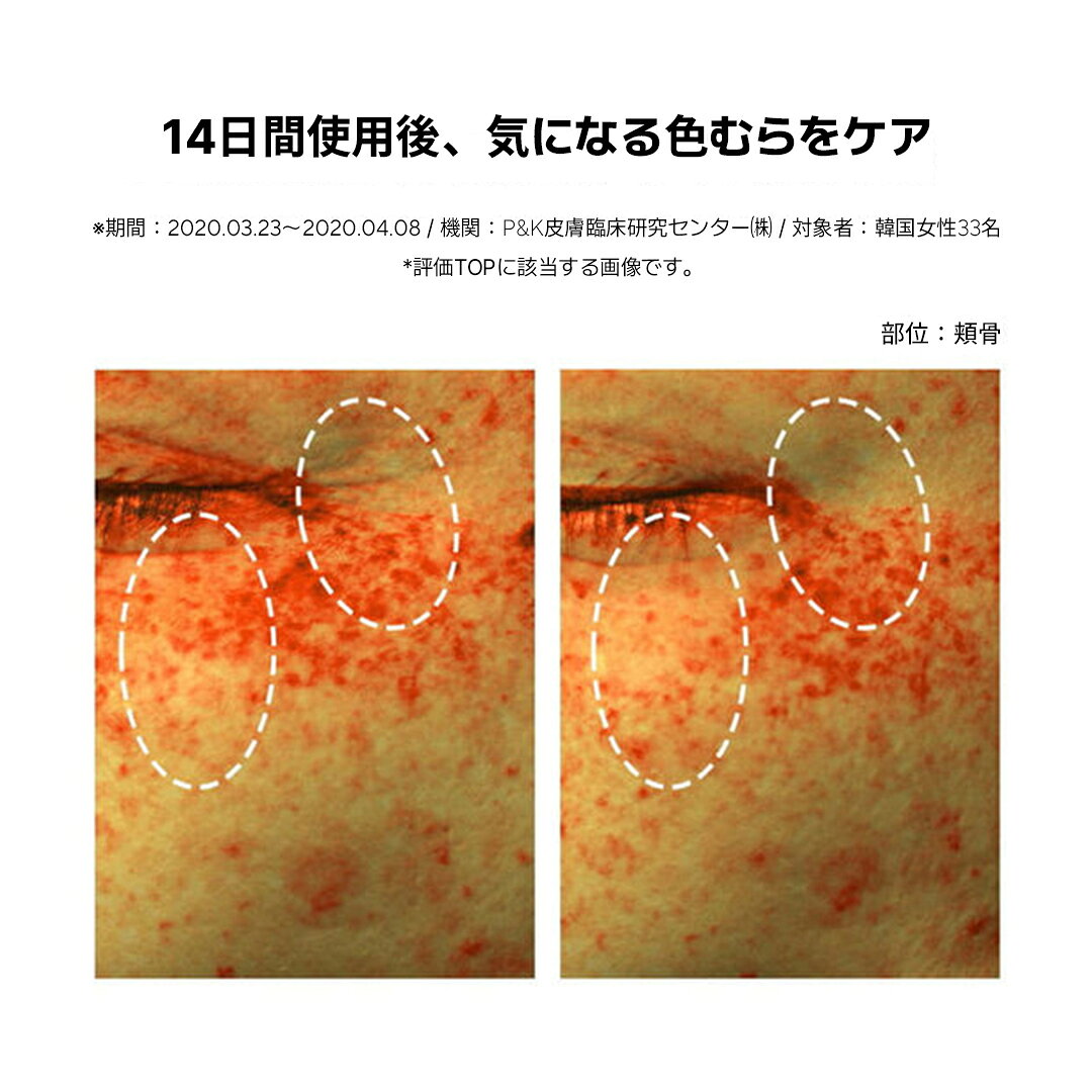 【IOPE公式】ブライトニング ダークスポット エッセンス 45ml 【 アイオペ 】 美容液 肌 キメ ツヤ 弾力 ハリ エイジングケア くすみ ダークスポット ゴワつき なめらか クリア肌 陶器肌 韓国 コスメ スキンケア 化粧品 アモーレパシフィック しっとり 乾燥 肌 amorepacific-10002823 AMOREMALL サンプル画像3
