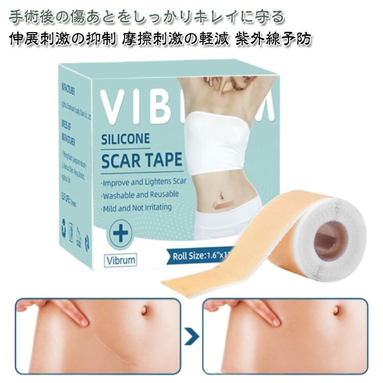 傷あとケアテープ 肌色 手術後 テープ 傷あとケア用シリコンジェルシート 帝王切開 隠す タトゥー ケロイド タトゥー隠し 通気性 tatooかくし 目立たない 刺青隠し 傷跡かくし