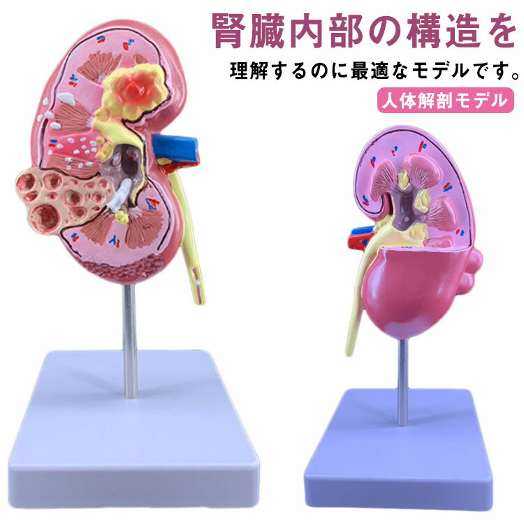 腎臓断面図 人体模型 腎臓 医師 モデル 泌尿器 図鑑 疾患展示模型 医療 腎臓 模型 腎臓 人体解剖モデル 置物 標本 実験 教材 腎臓模型 研究 説明 腎臓の模型 学習 用 インテリア 医学 解剖 勉強 内臓模型