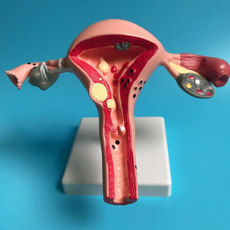 女性生殖器 実験 女性生殖器モデル 卵巣モデル 人体模型 女性子宮 女性卵巣 模型 子宮モデル 女性生殖器モデル 卵巣モデル人体モデル 標本 教材 子宮モデル 2