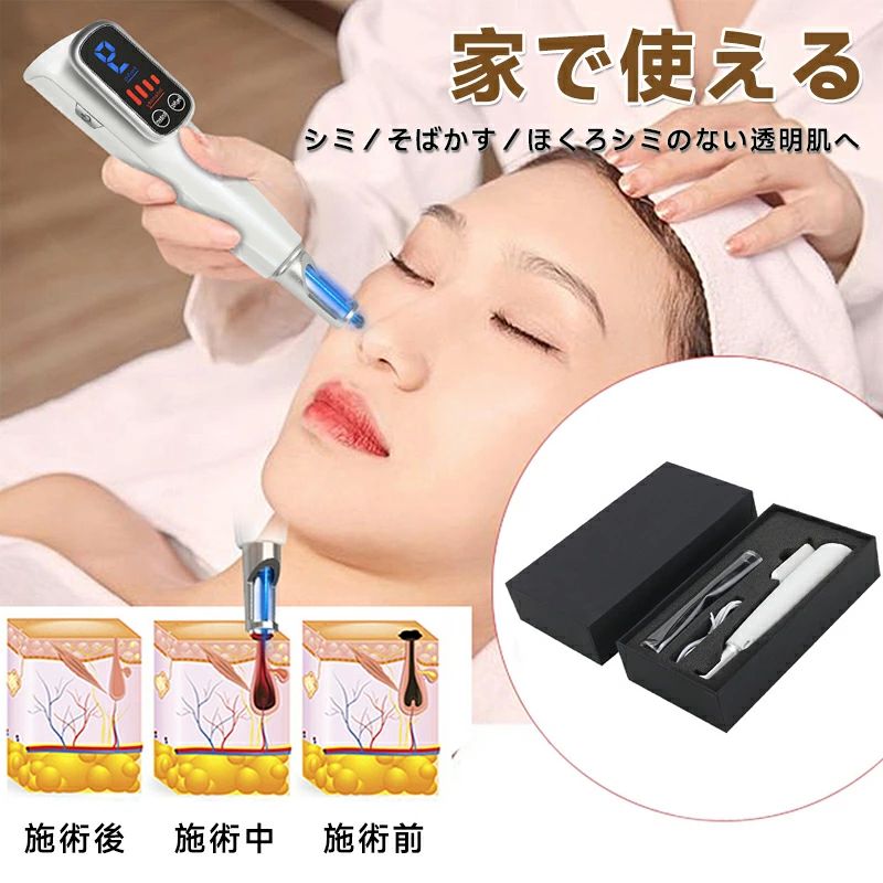 ピコ秒レーザー 傷跡 シワ 毛穴 そばかす レーザー 美容機器 赤色レーザー 青色レーザー 斑 シミ ほくろそばかす除去 美顔器 ピコレーザー 美顔器