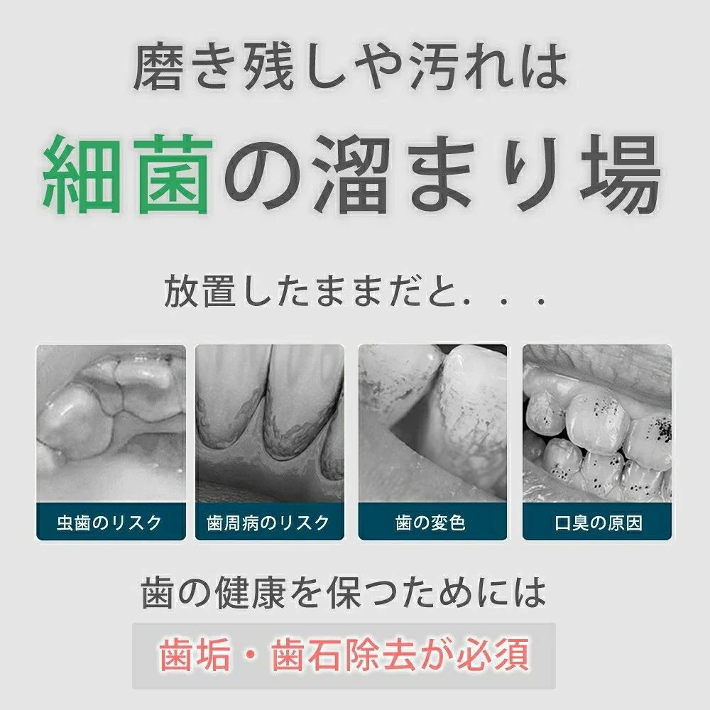 ashisuto13の歯石取り 家庭用歯石取りセット 口腔洗浄器 超音波 スケーラー 歯石 除去 超音波 歯周病 予防 歯 歯茎 歯周 口臭 歯間 自宅 口腔洗浄 デンタルケア USB充電 防水 耐水 LEDライト付｜アングル3