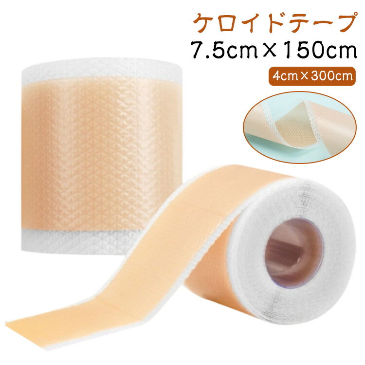 ꥨȤ㤨ֽץơ ơ 7.5cm150cm 벦ڳ ȩ  ơ ȥѥꥳ󥸥륷 Ѹ ơ åȲǽ ȥơ 4cm150cm 4cm300cm ץơ ꥳơ ݸơספβǤʤ1,570ߤˤʤޤ