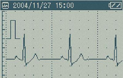 オムロン携帯型心電計 121×24×67mm ...の紹介画像3