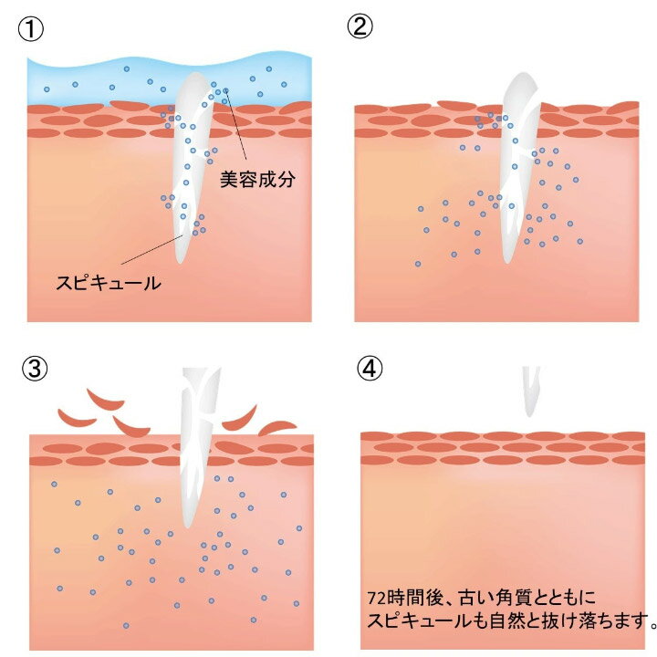 送料無料！正規品 SCボーテ プレミアム リバイタマスク＆インジェクション＜天然微細針入美容液＞美容液 シートマスク セット スピキュール ハリ つや 保湿 ほうれい線 たるみ 若々しさ キメ 弾力 うるおい 潤い 美白 コスメ 海洋深層水 美容専売 サロン専売
