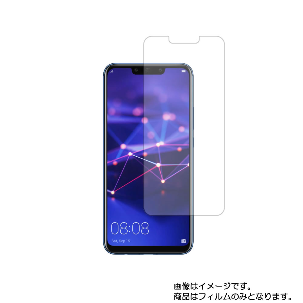 y2ZbgzHUAWEI Mate 20 lite SIMt[ py ˖h~ }bg mtB[ ^Cv zt ی tB  t@[EFC Cg20 Cg