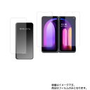 【3枚組x1セット】 LG V60 ThinQ 5G 用【 反射防止 マット ノンフィラー タイプ 】液晶 保護 フィルム ★ エルジー ブイシックスティー シンキュー ファイブジー 保護フィルム 激安