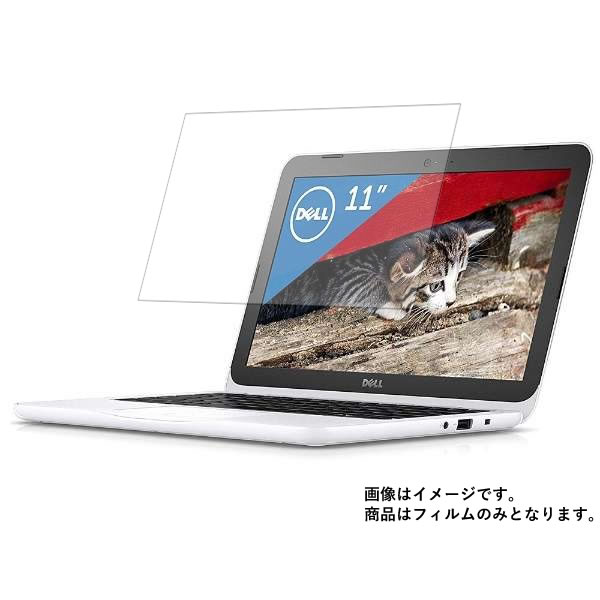 Dell Inspiron 11 3000(ホワイト) MI11-7HHBW(2017年春モデル) 用 10 【 マット 反射低減 】 液晶 保護 フィルム ★ デル インスパイロン