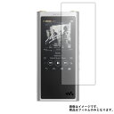 Sony Walkman ZX300 用【 安心の5大機能 