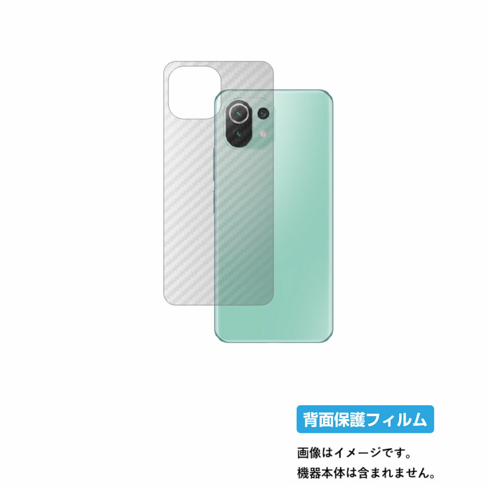 ڥѡSALE Ⱦ 50OFFXiaomi Mi 11 Lite 5G ѡ ܥĴ ꥢ   ݸ ե  㥪 ॢ ...