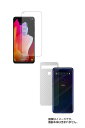 【2枚組(画面+背面)】TCL 10 Lite 用【 高機能 反射防止 スムースタッチ / 抗菌 】液晶 保護 フィルム+カーボン調背面 保護 フィルム ★ ティーシーエル テン ライト(2)