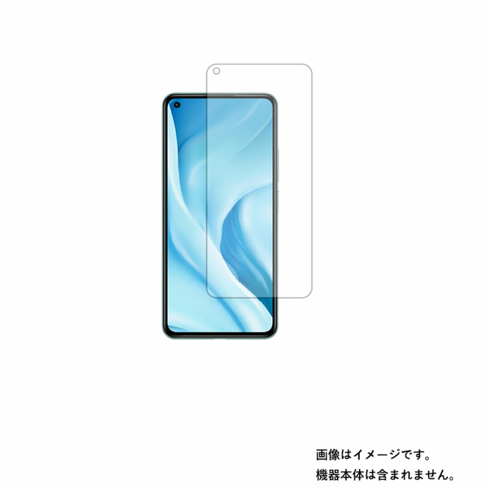 Xiaomi Mi 11 Lite 5G 用【 反射防止 マット ノンフィラー タイプ 】液晶 保護 フィルム ★ シャオミ エムアイ イレブン ライト ファイブジー