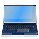 【3点セット(画面 パームレスト タッチパッド)】NEC LAVIE N14 Slim / Direct N14 Slim 2023年秋冬(11月)モデル 用 N35 安心の5大機能 衝撃吸収 ブルーライト カット 液晶 保護 フィルム ＋ カーボン調 保護フィルム 反射防止 抗菌 気泡レス ★