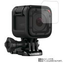 GoPro HERO Session CHDHS-102-JP2 レンズ部分 用【 マット 反射低減 】 液晶 保護 フィルム ★ ウェアラブルデバイス ウェアラブル アクションカメラ 液晶 画面 保護 フィルム シート 保護フィルム 保護シート