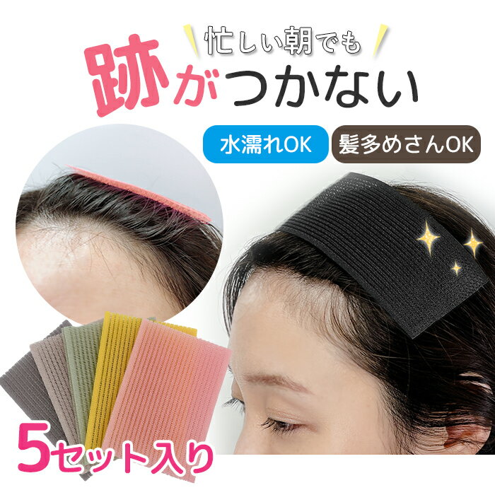 跡がつかないヘアピン・ヘアクリップ!使いやすい人気のものはどれ