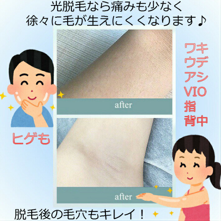 初回限定 Ipl 光 脱毛器 90万回 フラッシュ ライト交換不要 家庭用 脱毛機 美顔器 ヒゲ脱毛 レーザー 全身 脱毛 メンズ レディース ムダ毛 処理 デリケートゾーン アンダーヘア Vioライン 顔 背中 ボディ Www Eleventhcolumn Com 初回限定 Ipl 光 脱毛器 90万回 フラッシュ ライト交換不要 家庭用 脱毛機 美顔器 ヒゲ脱毛 レーザー 全身 脱毛 メンズ レディース ムダ毛 処理 デリケートゾーン アンダーヘア Vioライン 顔 背中 ボディ Www Eleventhcolumn Com