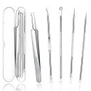 Restars 角栓取り 毛抜き ニキビ取り 抗菌ステンレス 毛穴ケア専用キット 黒ずみ取り 角栓 いちご 鼻ケア 携帯便利 収納ケース付き 5本セット