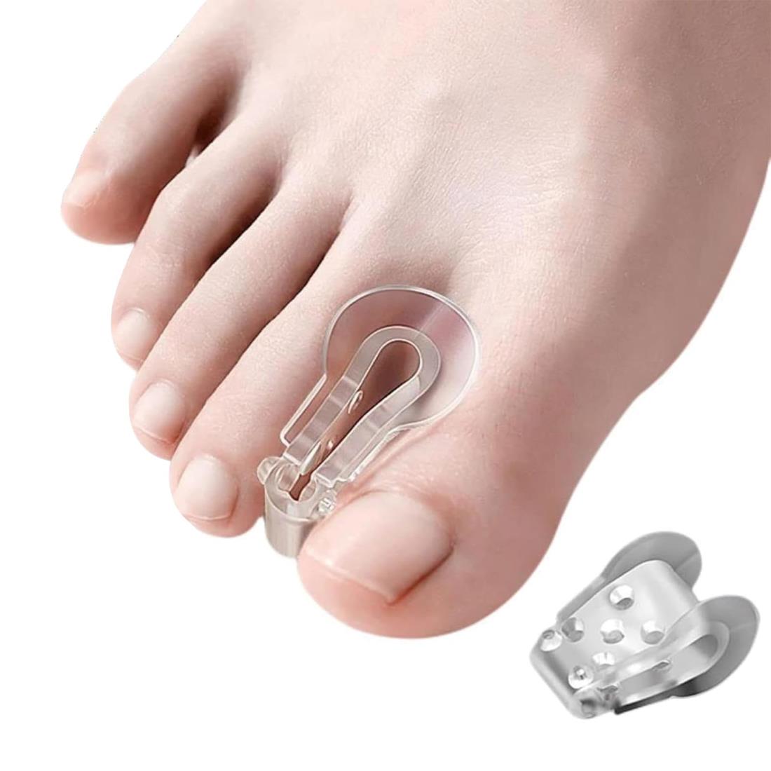 外反母趾 フィットパッド 足指サポーター 2個セット 外反母趾補助用具 足指グッズ 足指広げる 浮き指 ..