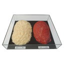 【暮らしラクラク応援セール】脂肪/筋肉対比セット(アクリルケース入)3kg IP-984【取り寄せ・返品不可商品】