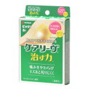【暮らしラクラク応援セール】ニチバン ケアリーヴ 治す力 ビッグ 5枚 478577【取り寄せ・返品不可商品】