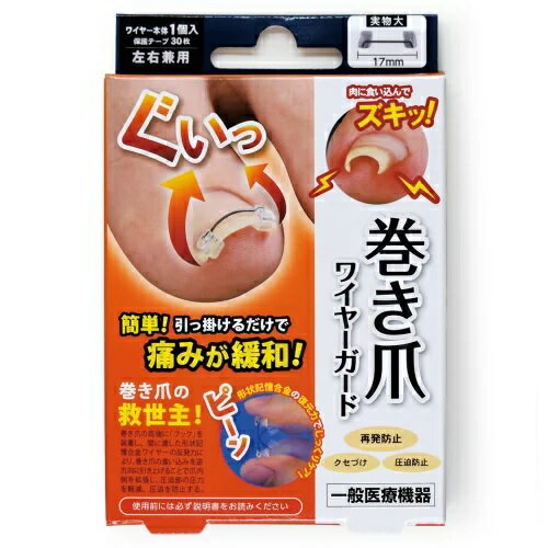 【10個セット】 巻き爪 ワイヤーガード 左右兼用 (1個)×10個セット【正規品】【k】【ご注文後発送までに1週間前後頂戴する場合がございます】爪切り【t-6】