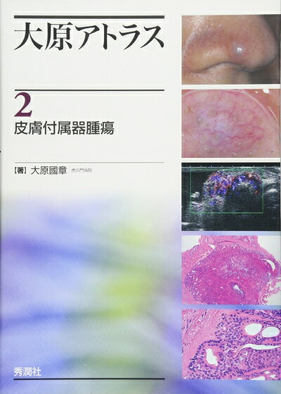 楽天市場】皮膚付属器腫瘍アトラスの通販