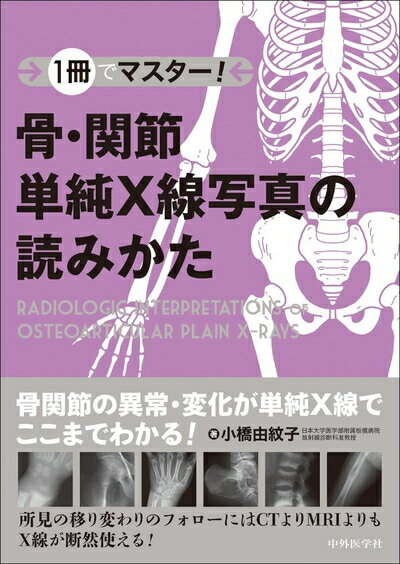 【中古】 1冊でマスター！　骨・関節単純X線写真の読みかた