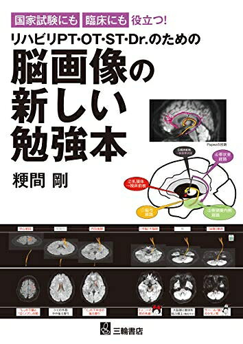 【商品名】国家試験にも臨床にも役立つ ! リハビリPT・OT・ST・Dr.のための脳画像の新しい勉強本（中古品）中古本の特性上【ヤケ、破れ、折れ、メモ書き、匂い】等がある場合がございます。特に状態が【可】の場合は書き込みや破れがある場合がございますので予めご承知おきのほどよろしくお願いいたします。読む分には問題ございません。また、商品名に【付属、特典、○○付き、ダウンロードコード】等の記載があっても中古品の場合は基本的にこれらは付属致しません。当店の中古品につきましては商品チェックの上、問題がないものを取り扱っております。ご安心いただきました上でご購入ください。【ご注文〜発送完了までの流れ】ご注文は24時間365日受け付けております。ご注文後いただきました後に当店から注文確認メールが送信されます。発送までの期間といたしましては、ご決済完了後より2〜5営業日となります。発送完了後に発送通知番号記載のメールが送付されます。【ご注意事項】当店はお客様都合によるご注文・ご決済後のキャンセル・返品はお受けしておりません。ご承知おきのうえご注文をお願いいたします。当店は一部商品を他モール等と併売させていただいております。完売の際はご連絡させていただきます。予めご承知おきのほどお願いいたします。