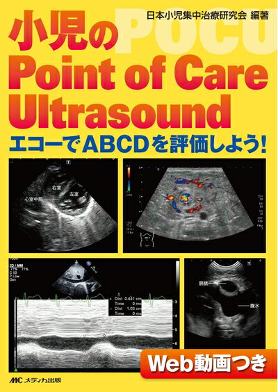 š Point of Care Ultrasound: ABCDɾ褦!