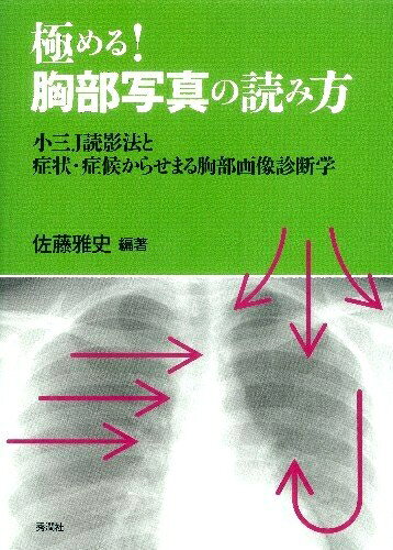 【商品名】極める!胸部写真の読み方: 小三J読影法と症状・症候からせまる胸部画像診断学（中古品）中古本の特性上【ヤケ、破れ、折れ、メモ書き、匂い】等がある場合がございます。特に状態が【可】の場合は書き込みや破れがある場合がございますので予めご承知おきのほどよろしくお願いいたします。読む分には問題ございません。また、商品名に【付属、特典、○○付き、ダウンロードコード】等の記載があっても中古品の場合は基本的にこれらは付属致しません。当店の中古品につきましては商品チェックの上、問題がないものを取り扱っております。ご安心いただきました上でご購入ください。【ご注文〜発送完了までの流れ】ご注文は24時間365日受け付けております。ご注文後いただきました後に当店から注文確認メールが送信されます。発送までの期間といたしましては、ご決済完了後より2〜5営業日となります。発送完了後に発送通知番号記載のメールが送付されます。【ご注意事項】当店はお客様都合によるご注文・ご決済後のキャンセル・返品はお受けしておりません。ご承知おきのうえご注文をお願いいたします。当店は一部商品を他モール等と併売させていただいております。完売の際はご連絡させていただきます。予めご承知おきのほどお願いいたします。
