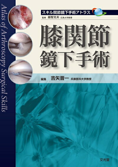 【商品名】膝関節鏡下手術（中古品）中古本の特性上【ヤケ、破れ、折れ、メモ書き、匂い】等がある場合がございます。特に状態が【可】の場合は書き込みや破れがある場合がございますので予めご承知おきのほどよろしくお願いいたします。読む分には問題ございません。また、商品名に【付属、特典、○○付き、ダウンロードコード】等の記載があっても中古品の場合は基本的にこれらは付属致しません。当店の中古品につきましては商品チェックの上、問題がないものを取り扱っております。ご安心いただきました上でご購入ください。【ご注文〜発送完了までの流れ】ご注文は24時間365日受け付けております。ご注文後いただきました後に当店から注文確認メールが送信されます。発送までの期間といたしましては、ご決済完了後より2〜5営業日となります。発送完了後に発送通知番号記載のメールが送付されます。【ご注意事項】当店はお客様都合によるご注文・ご決済後のキャンセル・返品はお受けしておりません。ご承知おきのうえご注文をお願いいたします。当店は一部商品を他モール等と併売させていただいております。完売の際はご連絡させていただきます。予めご承知おきのほどお願いいたします。