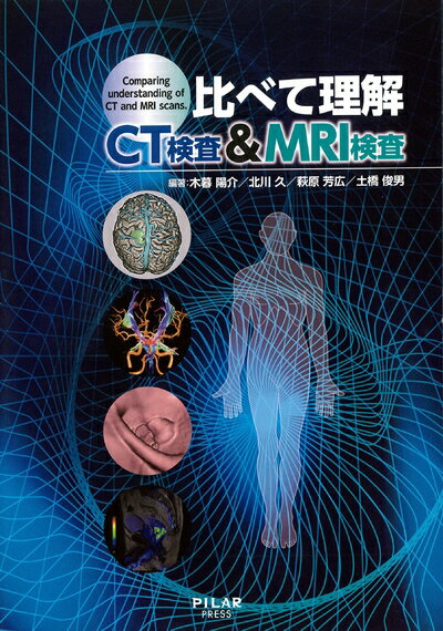 【商品名】比べて理解CT検査&MRI検査（中古品）中古本の特性上【ヤケ、破れ、折れ、メモ書き、匂い】等がある場合がございます。特に状態が【可】の場合は書き込みや破れがある場合がございますので予めご承知おきのほどよろしくお願いいたします。読む分には問題ございません。また、商品名に【付属、特典、○○付き、ダウンロードコード】等の記載があっても中古品の場合は基本的にこれらは付属致しません。当店の中古品につきましては商品チェックの上、問題がないものを取り扱っております。ご安心いただきました上でご購入ください。【ご注文〜発送完了までの流れ】ご注文は24時間365日受け付けております。ご注文後いただきました後に当店から注文確認メールが送信されます。発送までの期間といたしましては、ご決済完了後より2〜5営業日となります。発送完了後に発送通知番号記載のメールが送付されます。【ご注意事項】当店はお客様都合によるご注文・ご決済後のキャンセル・返品はお受けしておりません。ご承知おきのうえご注文をお願いいたします。当店は一部商品を他モール等と併売させていただいております。完売の際はご連絡させていただきます。予めご承知おきのほどお願いいたします。