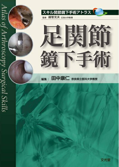 楽天市場】スキル関節鏡下手術アトラスの通販 楽天市場】スキル関節鏡下手術アトラスの通販