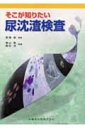 【中古】 そこが知りたい尿沈渣検査
