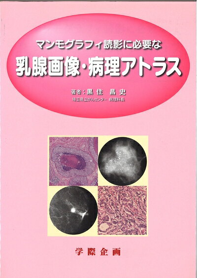 【商品名】マンモグラフィ読影に必要な乳腺画像・病理アトラス（中古品）中古本の特性上【ヤケ、破れ、折れ、メモ書き、匂い】等がある場合がございます。特に状態が【可】の場合は書き込みや破れがある場合がございますので予めご承知おきのほどよろしくお願いいたします。読む分には問題ございません。また、商品名に【付属、特典、○○付き、ダウンロードコード】等の記載があっても中古品の場合は基本的にこれらは付属致しません。当店の中古品につきましては商品チェックの上、問題がないものを取り扱っております。ご安心いただきました上でご購入ください。【ご注文〜発送完了までの流れ】ご注文は24時間365日受け付けております。ご注文後いただきました後に当店から注文確認メールが送信されます。発送までの期間といたしましては、ご決済完了後より2〜5営業日となります。発送完了後に発送通知番号記載のメールが送付されます。【ご注意事項】当店はお客様都合によるご注文・ご決済後のキャンセル・返品はお受けしておりません。ご承知おきのうえご注文をお願いいたします。当店は一部商品を他モール等と併売させていただいております。完売の際はご連絡させていただきます。予めご承知おきのほどお願いいたします。