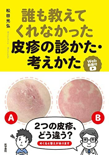 【中古】 誰も教えてくれなかった皮疹の診かた・考えかた[Web動画付]
