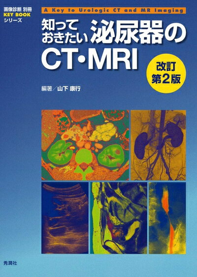 【中古】 知っておきたい泌尿器のCT・MRI　改訂第2版 (画像診断別冊KEY　BOOKシリーズ)