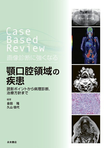 【中古】 Case Based Review 画像診断に強くなる 顎口腔領域の疾患 読影ポイントから病理診断,治療方針..