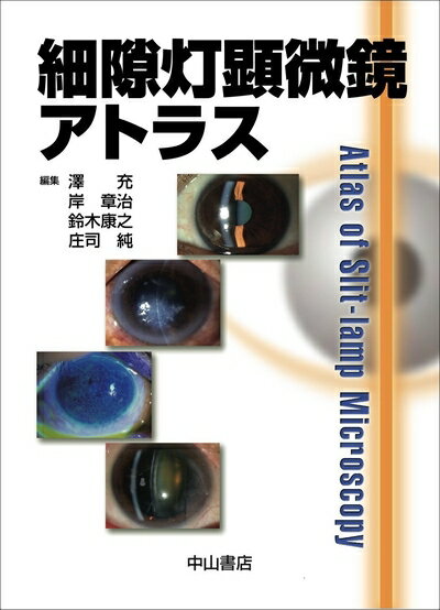 楽天市場】細隙灯顕微鏡アトラス（本・雑誌・コミック）の通販